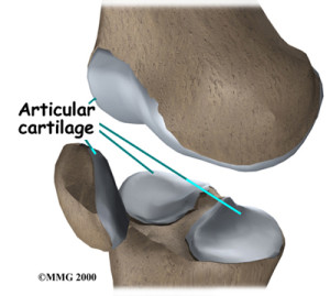 knee_cart_surg_anatomy01